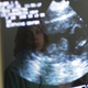 Illustration for article titled Abortion-Seekers in Texas Must Look at Sonogram, as if They Didnt Already Know What Was in There